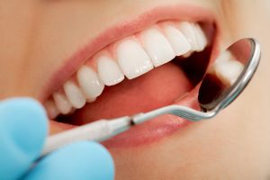 teeth whitening FAQs