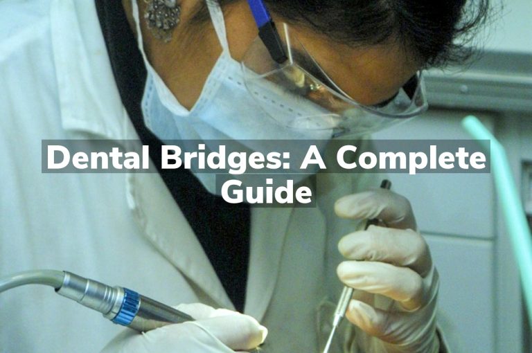 Dental Bridges: A Complete Guide